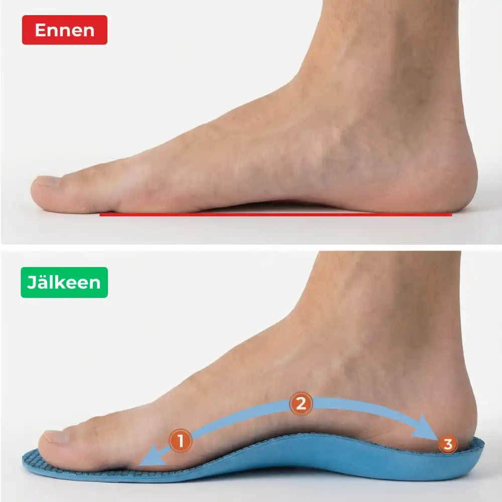 OrthoSole-pohjallisen holvikaaren tuki lähikuvassa